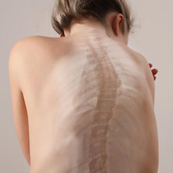 June is scoliosis awareness month